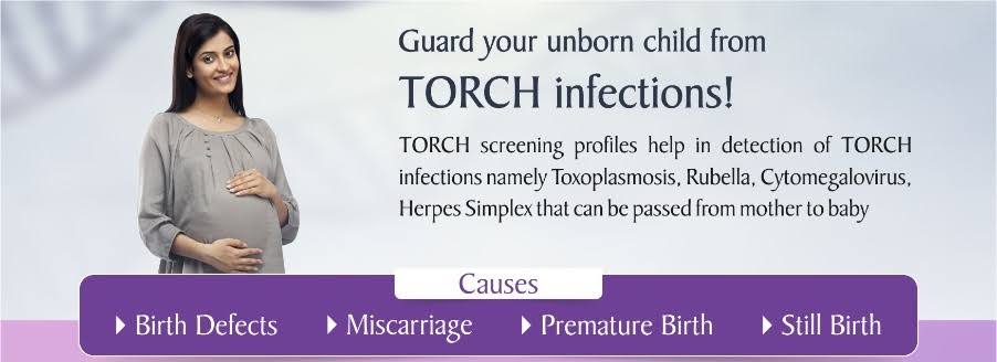 TORCH IGG & IGM